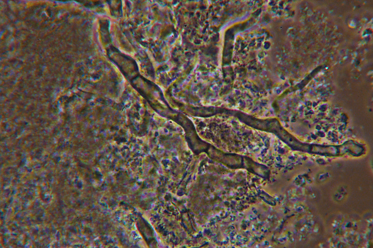Crosticina affiorante - foto 3379 (Byssomerulius corium?)